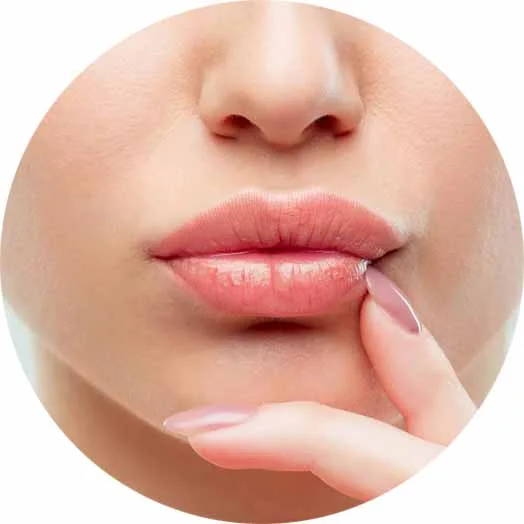 Filler labbra tecnica iLips Dr Lips - risultato naturale